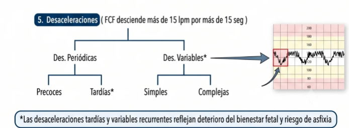 DESAELERACIONES8.png
