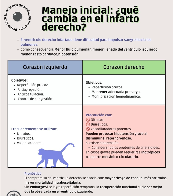 MANEJO ANTISQUEMICO IAM derecho vs izqeuirdo.png